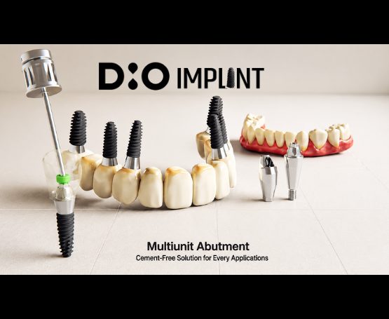 Dental 3D printing
