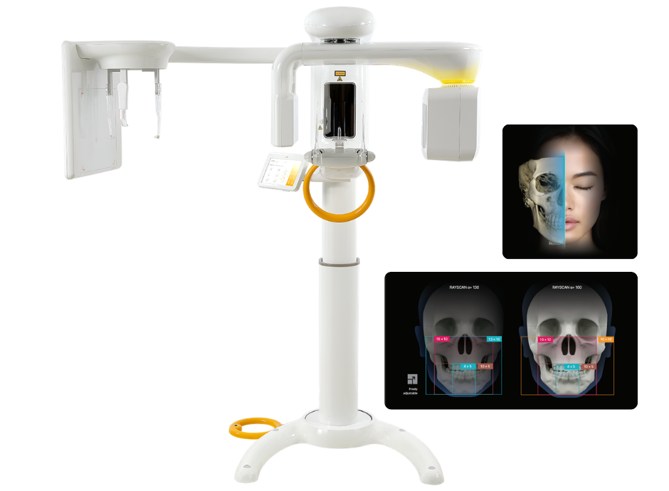 RAYSCAN α+